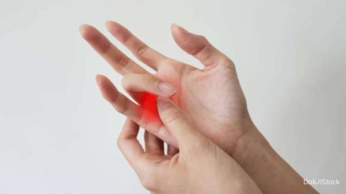 Kenali Apa Itu Trigger Finger Hingga Cara Pencegahannya di Sini
