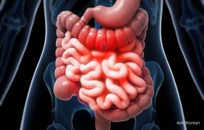 5 Cara Alami Membersihkan Usus Kotor dari Racun Sisa Makanan