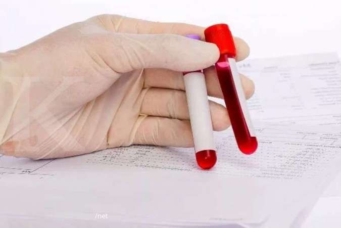 5 Makanan yang Harus Dihindari Penderita Darah Kental