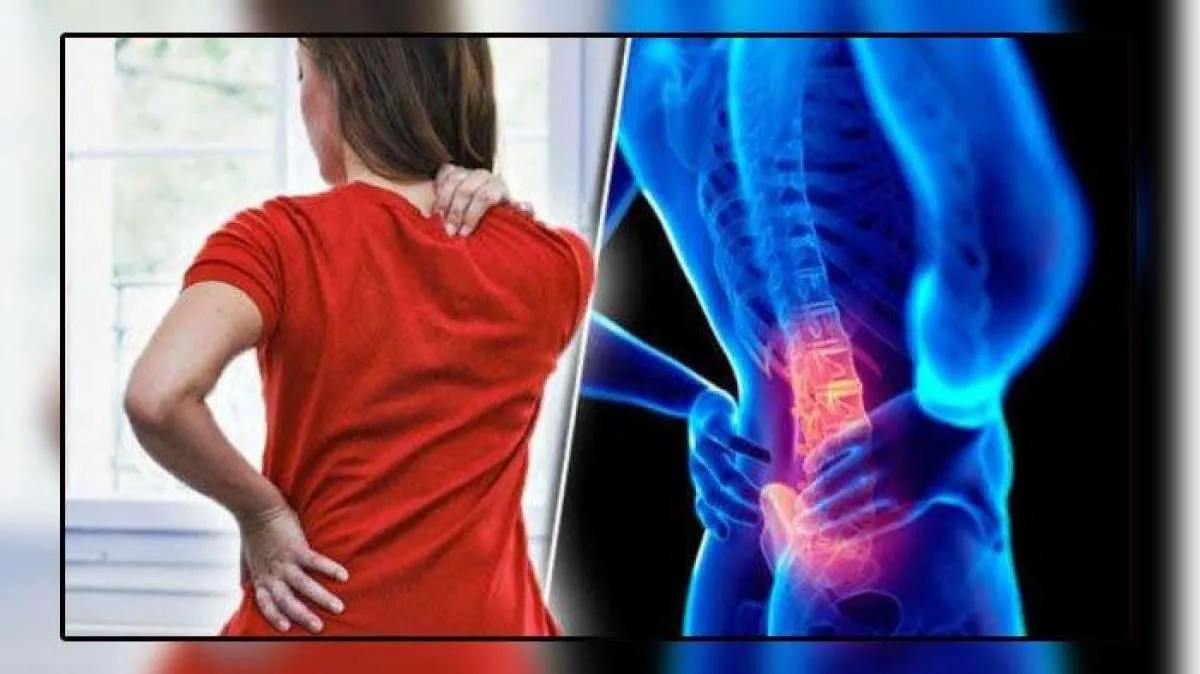Cara Mengatasi Nyeri Punggung Akibat Asam Lambung Tinggi 
