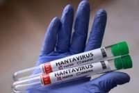 Apakah Sudah Ditemukan Hantavirus Jenis HPS di Indonesia? Ini Jawaban Kemenkes