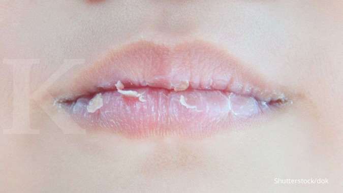 5 Cara Mengatasi Bibir Kering Menggunakan Bahan-Bahan Alami 