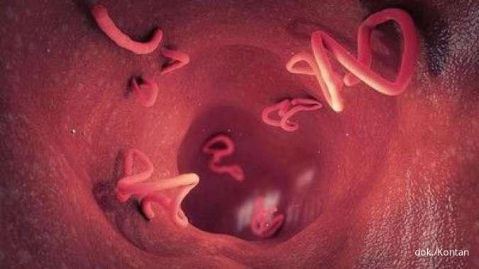 Viral Balita Tubuhnya Dipenuhi Cacing hingga Meninggal, Ini Cara Mencegah Cacingan