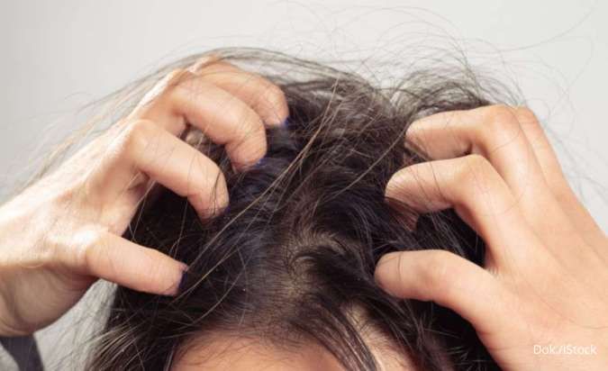 4 Cara Mengatasi Folikulitis atau Jerawat di Kepala, Bisa Pakai Tea Tree Oil