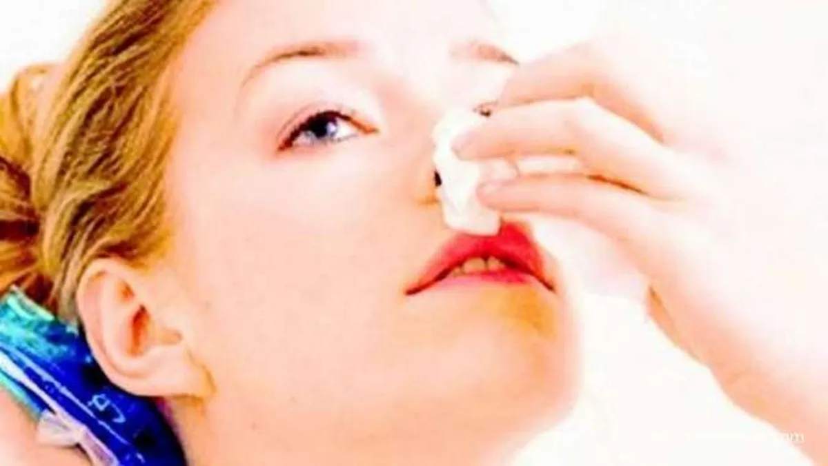 Cara Cepat Menghentikan Mimisan 