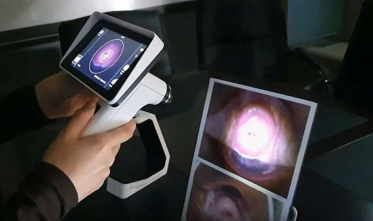 Pyridam Farma Hadirkan Perangkat Pendeteksi Kanker Serviks Berbasis AI