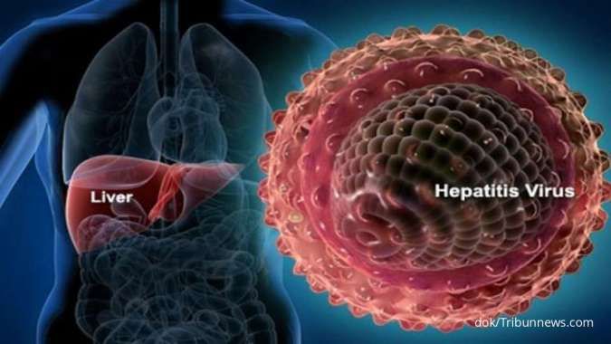 Mengenal Penyakit Hepatitis, Ciri-Ciri, Cara Penularan, serta Langkah Pencegahannya