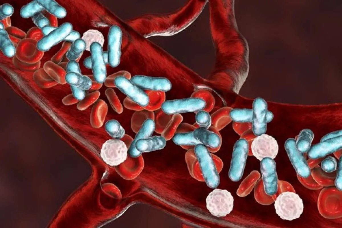 Moms, Kenali Gejala Sepsis biar Bisa Mengantisipasi dengan Tepat