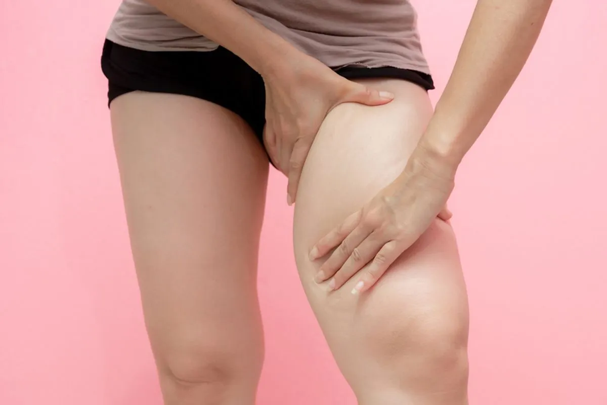 Paha Besar Bikin Minder? Ini 4 Cara Mengecilkan Paha dengan Cepat