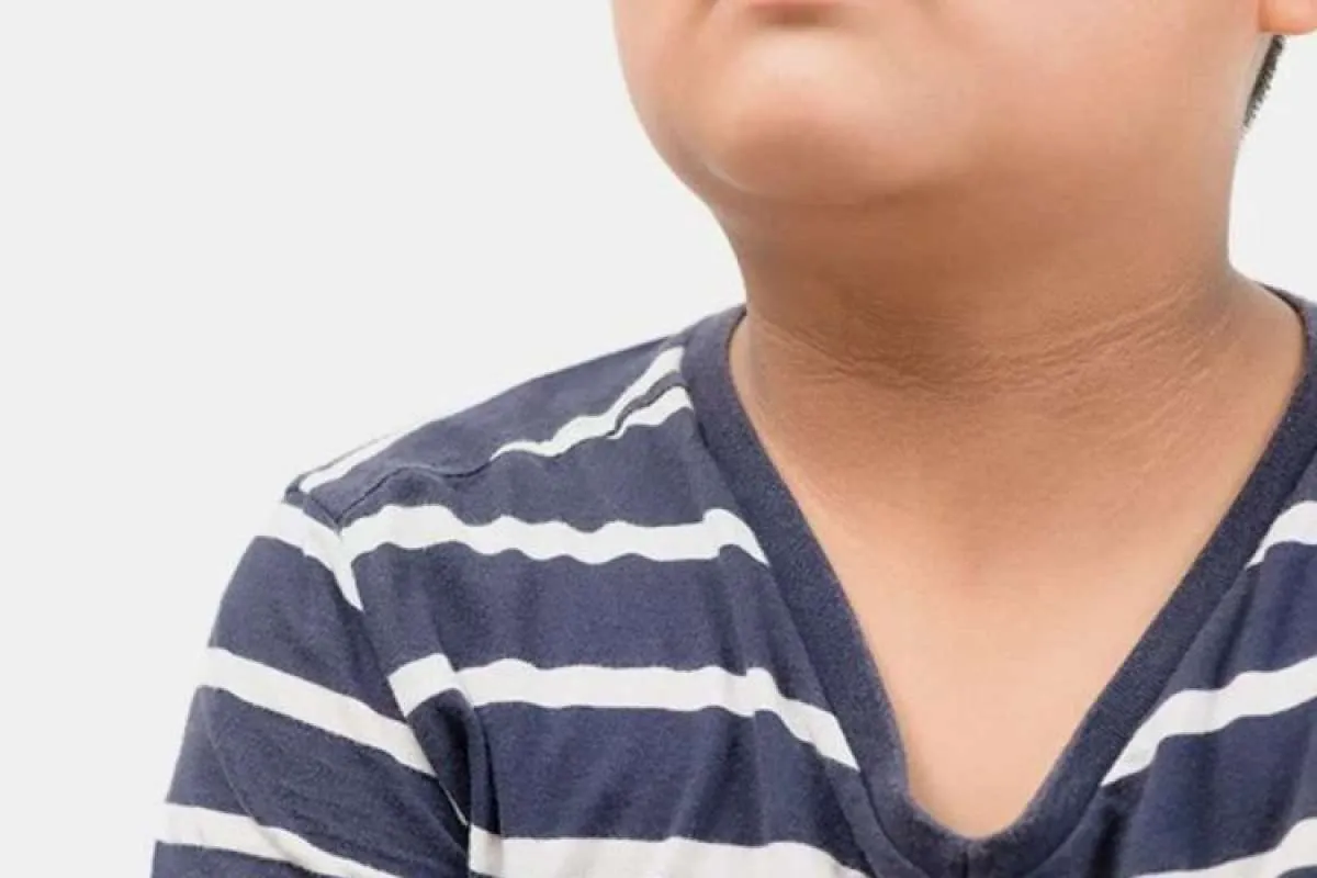 Patut Dicoba! 5 Cara Memutihkan Lipatan Tubuh dengan Bahan Alami