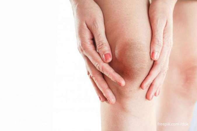 Asam Urat Serang Lutut Picu Peradangan, Ini Cara Mengatasinya di Rumah