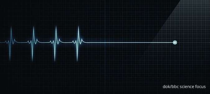  Tidak Sedang Sakit, Apa Penyebab Kematian Mendadak Sebenarnya?