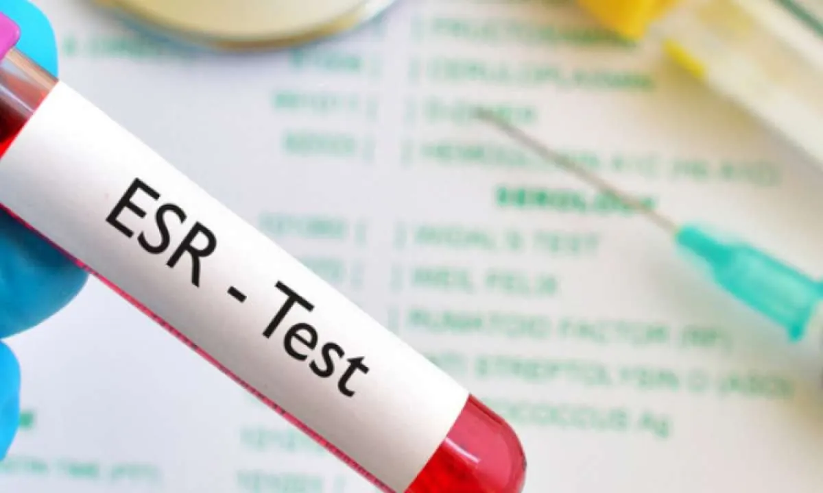 Kenali Penyebab Laju Endap Darah Meningkat