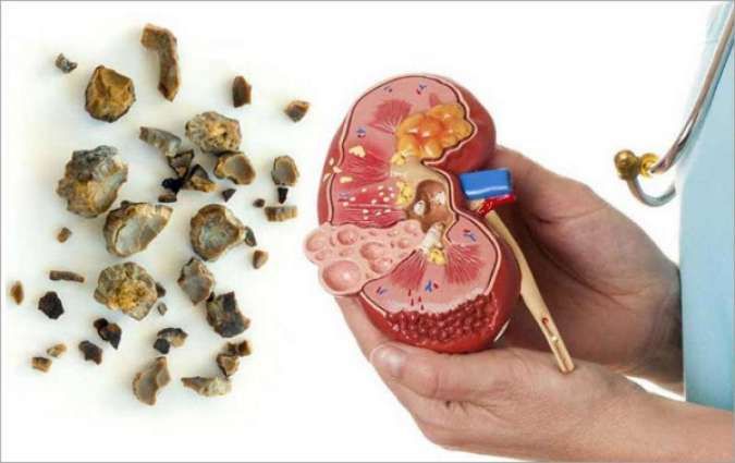 男性はどれくらいの頻度でHIV検査を受ける必要がありますか?