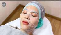 Eva Mulia Clinic Hadirkan Carboxy CO2 Treatment Untuk Kulit Glowing Tanpa Filter