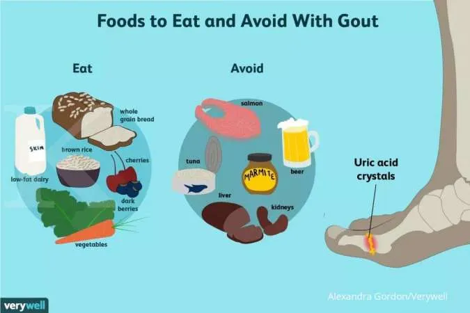 Makanan yang perlu dihindari dan diperbanyak jika memiliki penyakit asam urat