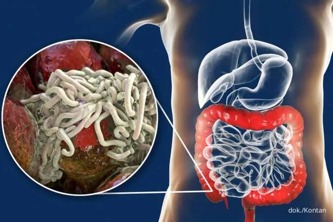 Begini Proses Masuk Cacing ke Dalam Tubuh Manusia dan Bahayanya, Kata Dokter