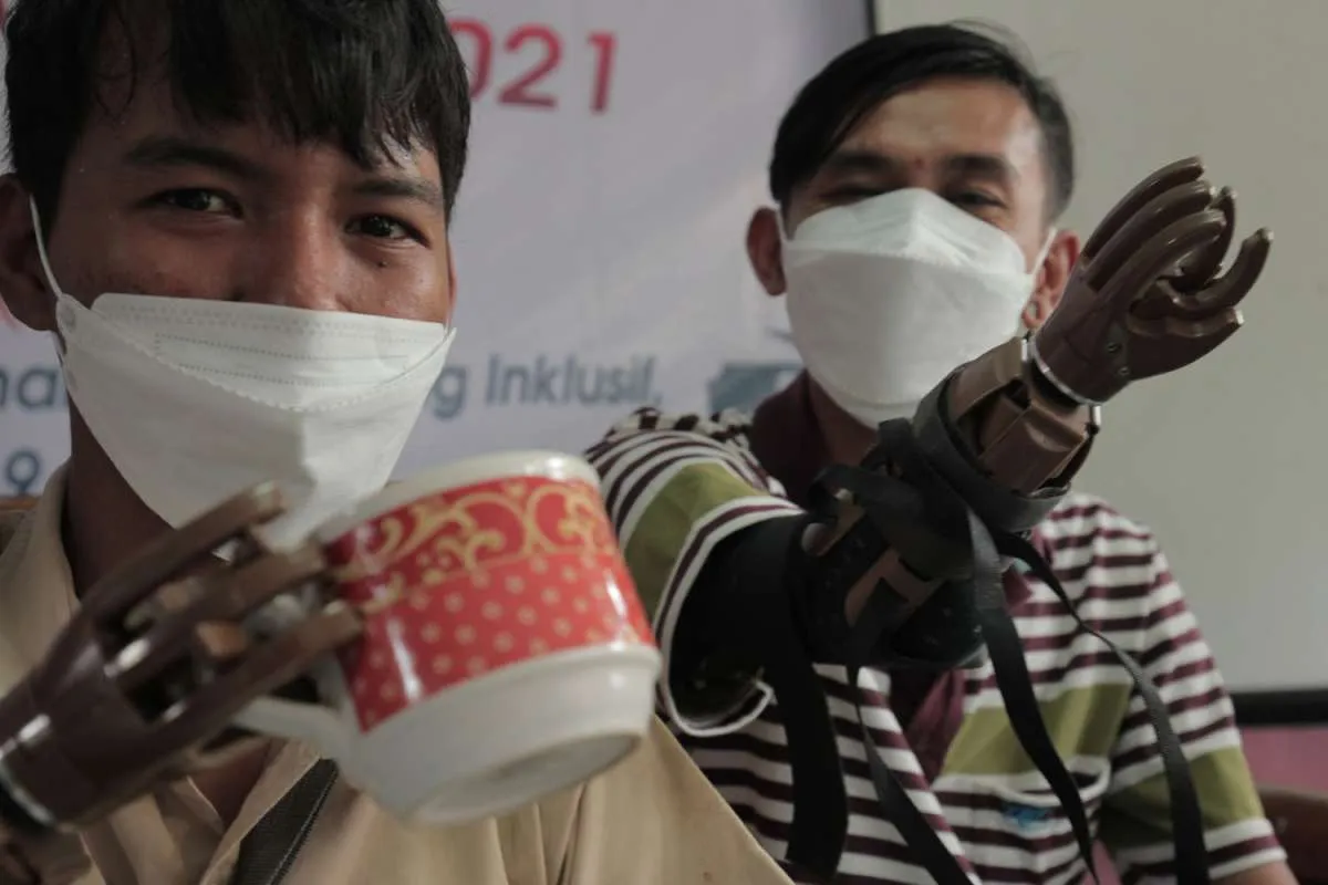 Cigna Indonesia distribusikan 13 tangan palsu ke masyarakat disabilitas