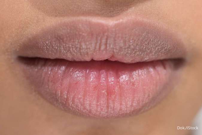 Selain Rokok, Ini 5 Penyebab Bibir Atas Menghitam yang Harus Anda Tahu