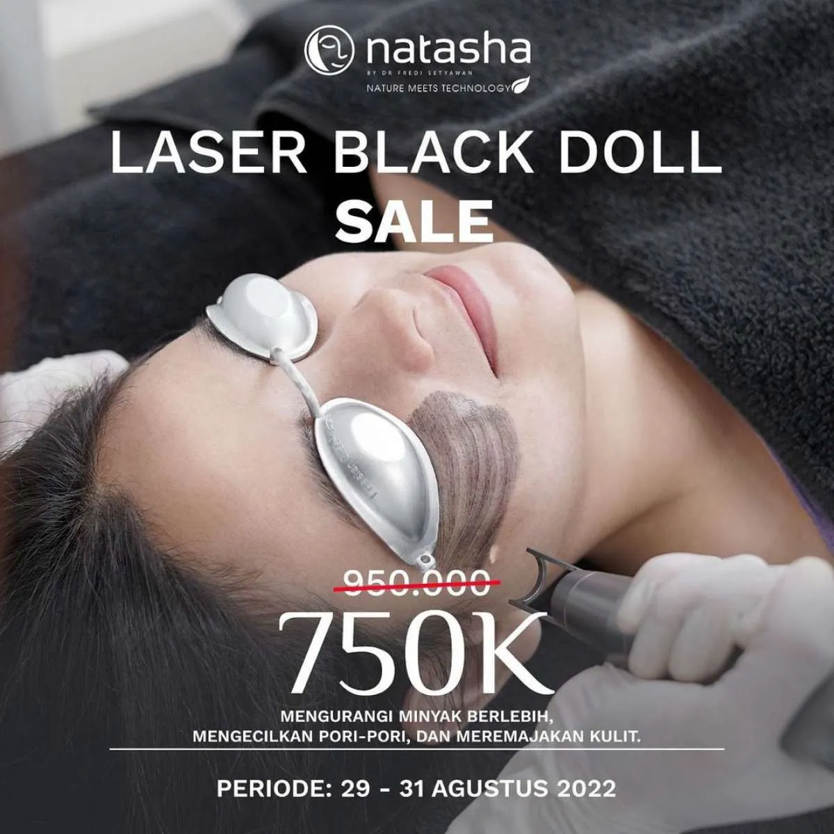 Promo Laser Black Doll Sale di Klinik Natasha, Harga Spesial sampai Akhir Agustus