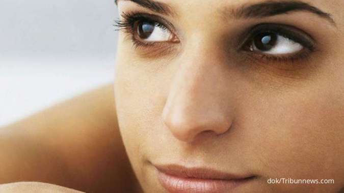 5 Cara Mengatasi Mata Sembab dan Penyebab Umum yang Picu Iritasi