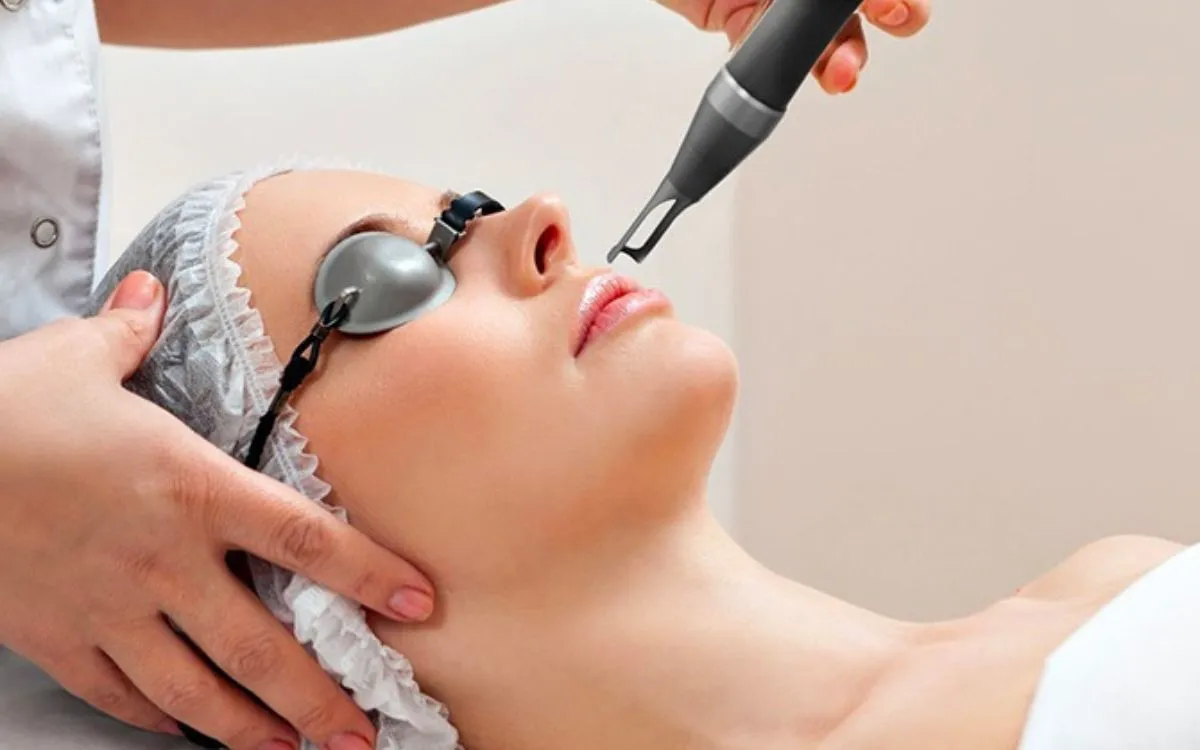 5 Pantangan Setelah Laser Wajah yang Harus Dihindari, Jangan Pakai Makeup Dulu Ya!