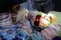 Perawatan Gigi Pakai BPJS? Cek Jenis Layanan yang Dicover