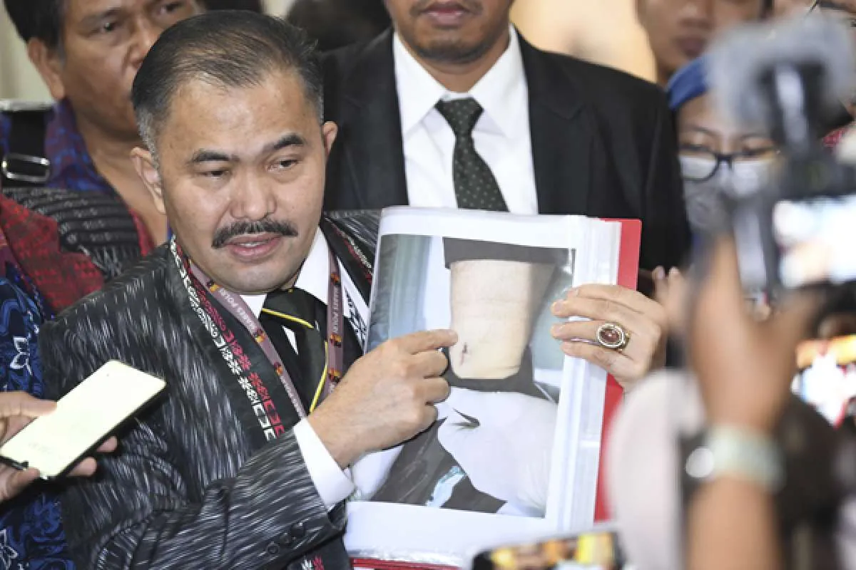 Polri akan Lakukan Otopsi Ulang Brigadir J