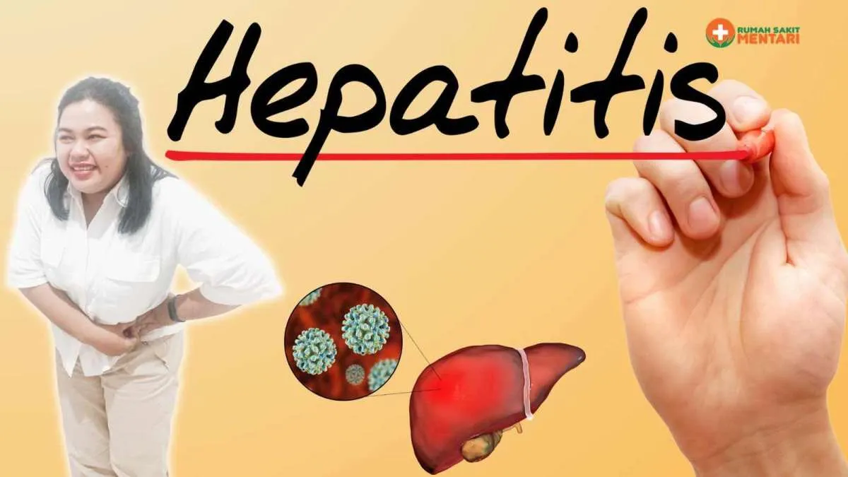 Hepatitis atau Peradangan Hati: Penyebab, Gejala, dan Pencegahannya