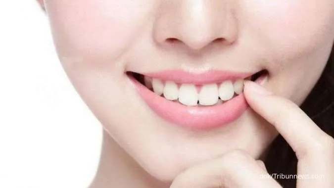 Gigi putih dan sehat
