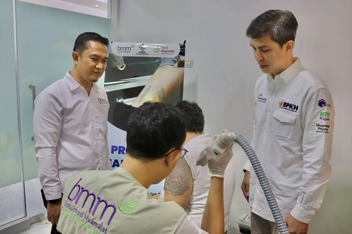 Bank Muamalat dan Baitulmaal Muamalat Gelar Program Hapus Tato Gratis 