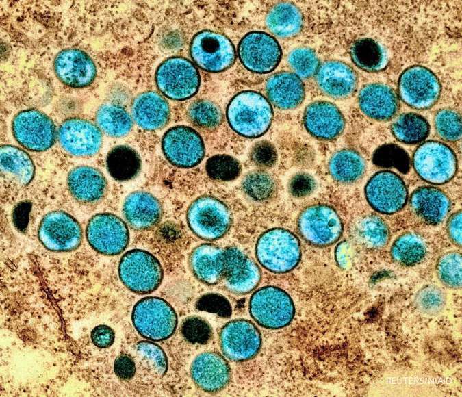 Cegah Penyebaran Virus Mpox, Pakistan Mulai Skrining Semua Wisatawan Masuk