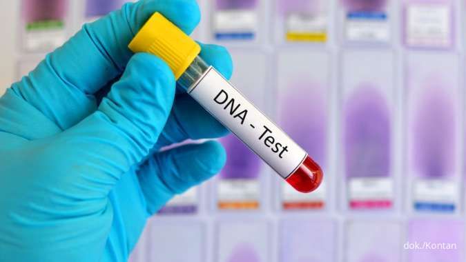 Ramai Pembicaraan tentang Tes DNA, Yuk Ketahui Prosedur Tes DNA Berikut Ini