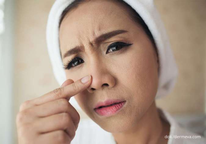 4 Penyebab Kulit Kering di Sekitar Hidung, Coba Perhatikan