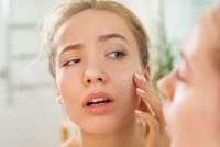 6 Tanda Kulit Wajah Stres yang Jarang Anda Sadari, Kusam dan Kering Termasuk