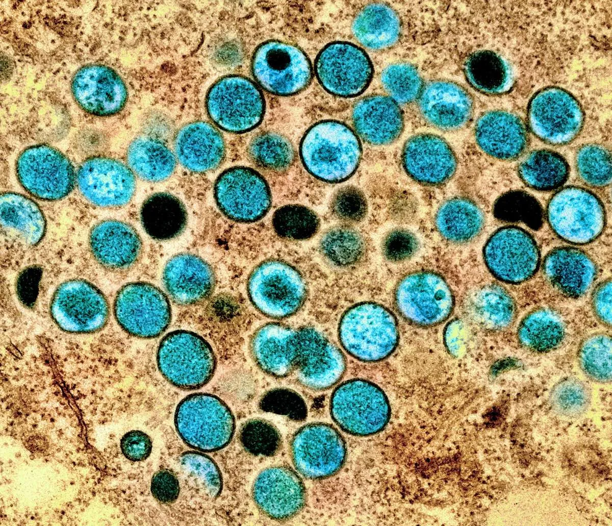 UNICEF Keluarkan Tender Darurat untuk Amankan Stok Vaksin Mpox
