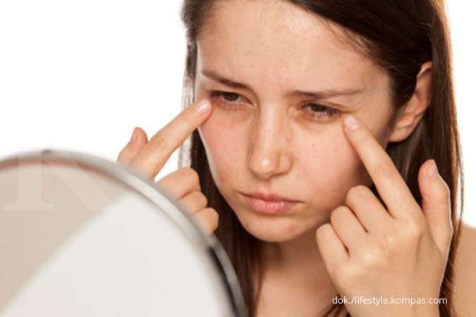 Kenali 5 Penyebab Munculnya Garis Halus di Sekitar Mata