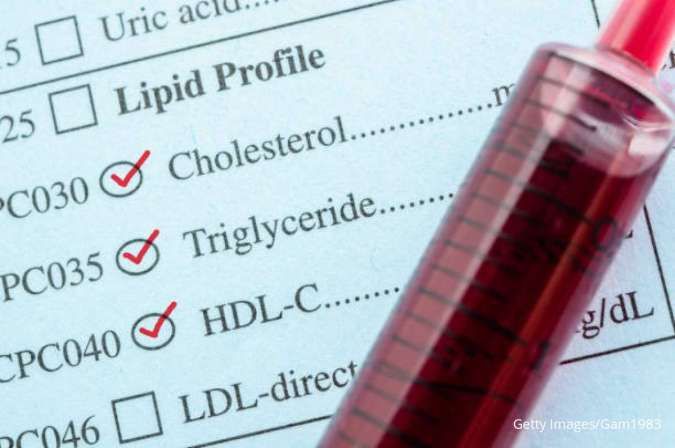 Cek Kolesterol Apakah Harus Puasa? Cari Tahu Jawabannya di Sini