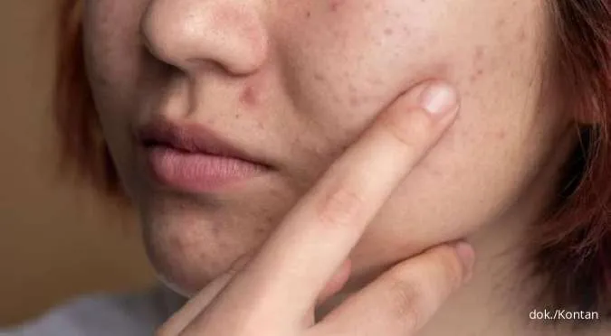 7 Kebiasaan yang Bikin Skin Barrier Rusak, Hindari ya