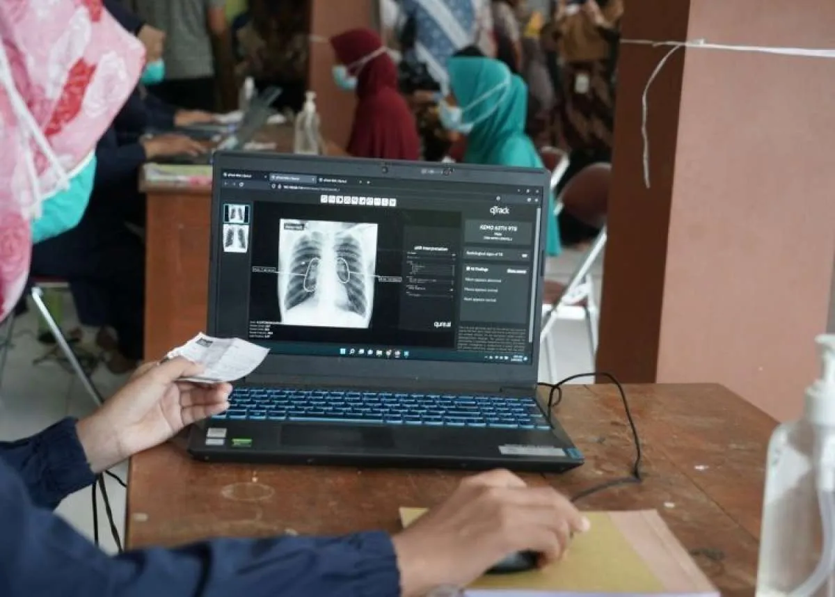 7 Pendekatan Kemenkes Deteksi Dini dan Perluas Layanan Tuberkulosis