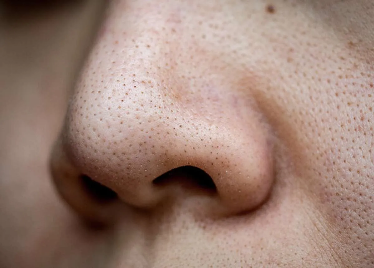 Ini 10 Makanan yang Dihindari saat Hidung Tersumbat, Ada Tomat hingga Susu