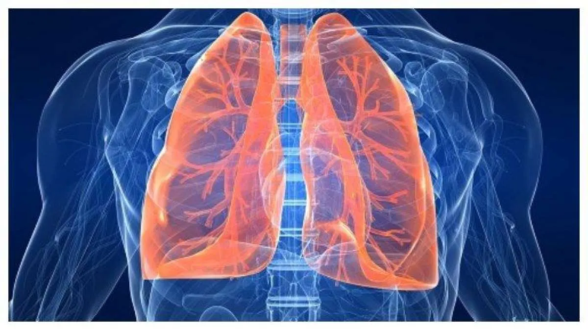 Kasus Mycoplasma Pneumonia Telah Ditemukan di Jakarta, Apa yang Harus Dilakukan?