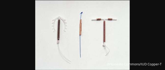IUD Copper T: Efektivitas, Jangka Waktu Pemakaian, Efek Samping, dan Manfaat
