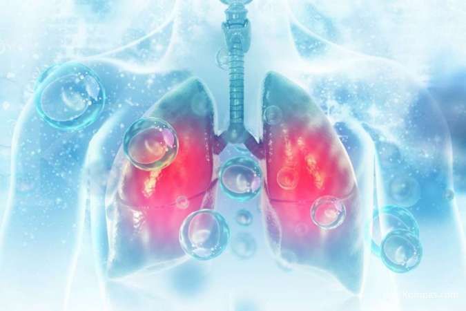 Catat! Ini 8 gejala radang paru-paru yang tidak boleh disepelekan 