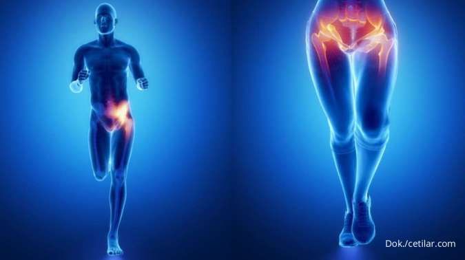 Ilustrasi cedera pubalgia.