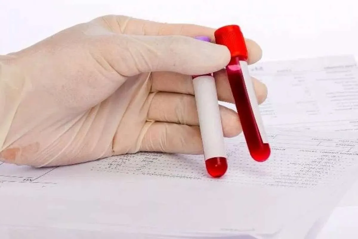 5 Makanan yang Harus Dihindari Penderita Darah Kental