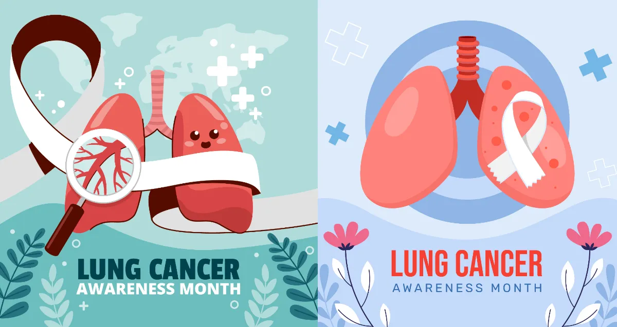 Duh, Sebanyak 90% Kanker Paru Terdeteksi Pada Stadium Lanjut 