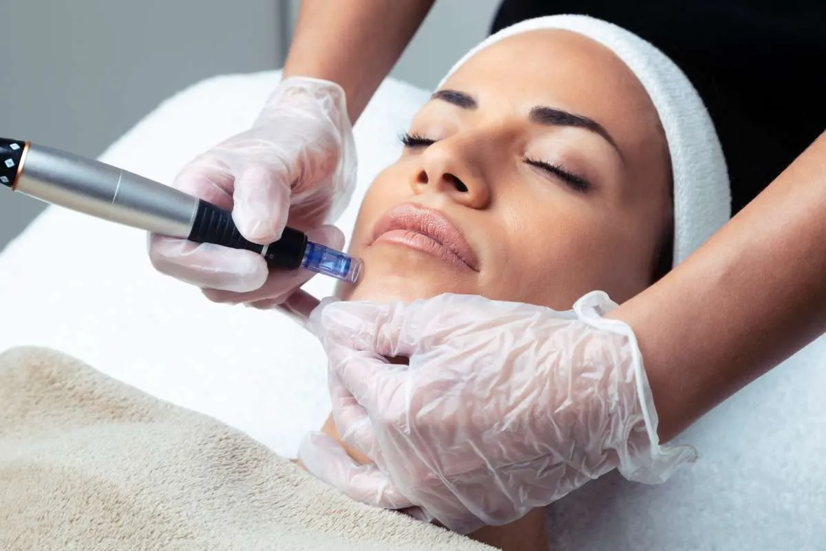 Apa Itu Microneedling? Ini 5 Manfaat Microneedling untuk Kulit