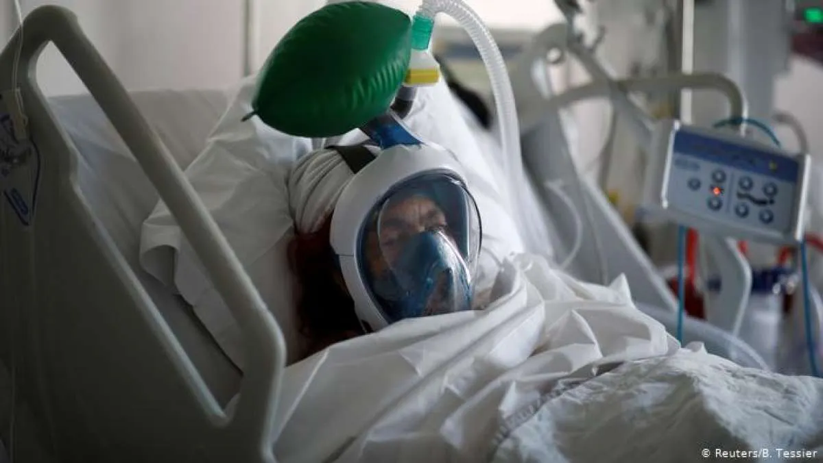 Kematian Meningkat, Dokter Berusaha Tidak Gunakan Ventilator untuk Covid-19