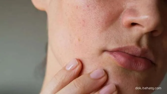 Inilah 4 Cara Mudah Memperbaiki Skin Barrier yang Rusak